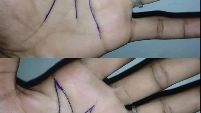 45693366